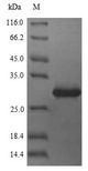 CDKN3 / KAP Protein - (Tris-Glycine gel) Discontinuous SDS-PAGE (reduced) with 5% enrichment gel and 15% separation gel.