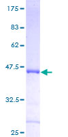 CDKN3 / KAP Protein - 12.5% SDS-PAGE of human CDKN3 stained with Coomassie Blue