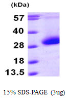 CDKN3 / KAP Protein