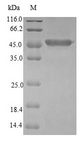 CDO1 / Cysteine Dioxygenase Protein - (Tris-Glycine gel) Discontinuous SDS-PAGE (reduced) with 5% enrichment gel and 15% separation gel.