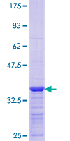 CDO1 / Cysteine Dioxygenase Protein - 12.5% SDS-PAGE Stained with Coomassie Blue.