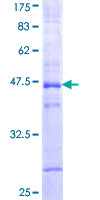 CDON / Cdo Protein - 12.5% SDS-PAGE Stained with Coomassie Blue.