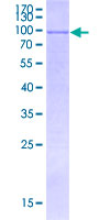 CDR2L Protein - 12.5% SDS-PAGE Stained with Coomassie Blue