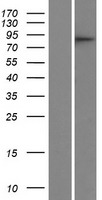 CDRT1 Protein - Western validation with an anti-DDK antibody * L: Control HEK293 lysate R: Over-expression lysate