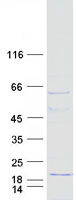 CDRT4 Protein - Purified recombinant protein CDRT4 was analyzed by SDS-PAGE gel and Coomassie Blue Staining