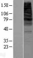 CDS2 Protein - Western validation with an anti-DDK antibody * L: Control HEK293 lysate R: Over-expression lysate
