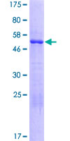 CDV3 Protein - 12.5% SDS-PAGE of human CDV3 stained with Coomassie Blue