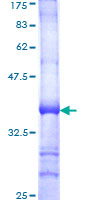 CDw218a / IL18R1 Protein - 12.5% SDS-PAGE Stained with Coomassie Blue.