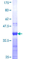 CDX1 Protein - 12.5% SDS-PAGE Stained with Coomassie Blue.