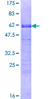 CDX2 Protein - 12.5% SDS-PAGE of human CDX2 stained with Coomassie Blue