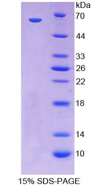 CDX2 Protein - Recombinant  Caudal Type Homeobox Transcription Factor 2 By SDS-PAGE