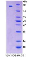 CDX2 Protein - Recombinant  Caudal Type Homeobox Transcription Factor 2 By SDS-PAGE