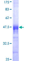 CDX4 Protein - 12.5% SDS-PAGE Stained with Coomassie Blue.