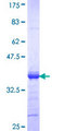 CDY2A / CDY Protein - 12.5% SDS-PAGE Stained with Coomassie Blue.