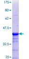 CDYL Protein - 12.5% SDS-PAGE Stained with Coomassie Blue.
