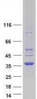 CDYL Protein - Purified recombinant protein CDYL was analyzed by SDS-PAGE gel and Coomassie Blue Staining