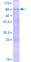 CDYL2 Protein - 12.5% SDS-PAGE of human CDYL2 stained with Coomassie Blue