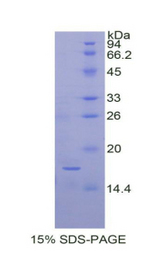CEA / Carcinoembryonic Antigen Protein - Recombinant Carcinoembryonic Antigen By SDS-PAGE