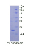 CEA / Carcinoembryonic Antigen Protein - Recombinant Carcinoembryonic Antigen By SDS-PAGE