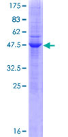 CEACAM21 Protein - 12.5% SDS-PAGE of human CEACAM21 stained with Coomassie Blue