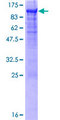 CEACAM5 / CD66e Protein - 12.5% SDS-PAGE of human CEACAM5 stained with Coomassie Blue