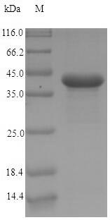 CEACAM7 Protein - (Tris-Glycine gel) Discontinuous SDS-PAGE (reduced) with 5% enrichment gel and 15% separation gel.