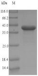 CEACAM7 Protein - (Tris-Glycine gel) Discontinuous SDS-PAGE (reduced) with 5% enrichment gel and 15% separation gel.