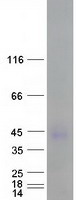 CEACAM7 Protein - Purified recombinant protein CEACAM7 was analyzed by SDS-PAGE gel and Coomassie Blue Staining