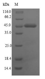 CEACAM8 / CD66b Protein - (Tris-Glycine gel) Discontinuous SDS-PAGE (reduced) with 5% enrichment gel and 15% separation gel.