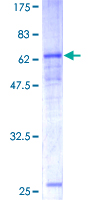 CEACAM8 / CD66b Protein - 12.5% SDS-PAGE of human CEACAM8 stained with Coomassie Blue
