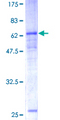 CEACAM8 / CD66b Protein - 12.5% SDS-PAGE of human CEACAM8 stained with Coomassie Blue