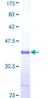 CEB1 / HERC5 Protein - 12.5% SDS-PAGE Stained with Coomassie Blue.