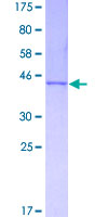 CEBPG / CEBP Gamma Protein - 12.5% SDS-PAGE of human CEBPG stained with Coomassie Blue