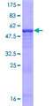 CECR1 Protein - 12.5% SDS-PAGE of human CECR1 stained with Coomassie Blue