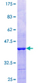 CECR1 Protein - 12.5% SDS-PAGE Stained with Coomassie Blue.