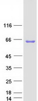 CECR1 Protein - Purified recombinant protein CECR1 was analyzed by SDS-PAGE gel and Coomassie Blue Staining