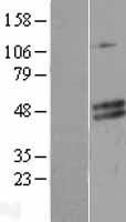 CECR5 Protein - Western validation with an anti-DDK antibody * L: Control HEK293 lysate R: Over-expression lysate