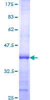 CEL / Carboxyl Ester Lipase Protein - 12.5% SDS-PAGE Stained with Coomassie Blue.