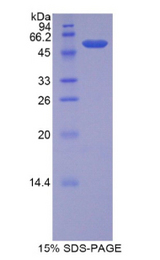 CEL / Carboxyl Ester Lipase Protein - Recombinant Lipase, Bile Salt Dependent By SDS-PAGE