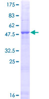 CELA1 / Pancreatic Elastase 1 Protein - 12.5% SDS-PAGE of human ELA1 stained with Coomassie Blue