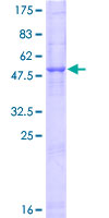 CELA2B / ELA2B Protein - 12.5% SDS-PAGE of human ELA2B stained with Coomassie Blue