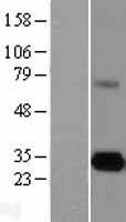 CELA3A / ELA3 Protein - Western validation with an anti-DDK antibody * L: Control HEK293 lysate R: Over-expression lysate