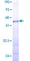 CELA3A / ELA3 Protein - 12.5% SDS-PAGE of human ELA3A stained with Coomassie Blue