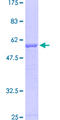 CELA3B / ELA3B Protein - 12.5% SDS-PAGE of human ELA3B stained with Coomassie Blue