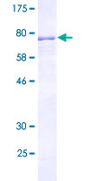 CELF3 Protein - 12.5% SDS-PAGE of human TNRC4 stained with Coomassie Blue