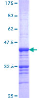 CELSR2 Protein - 12.5% SDS-PAGE Stained with Coomassie Blue.