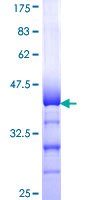 CELSR3 Protein - 12.5% SDS-PAGE Stained with Coomassie Blue.