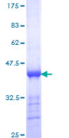 CENPE Protein - 12.5% SDS-PAGE Stained with Coomassie Blue.