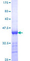 CENPE Protein - 12.5% SDS-PAGE Stained with Coomassie Blue.