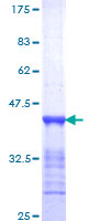 CENPF / CENP-F Protein - 12.5% SDS-PAGE Stained with Coomassie Blue.